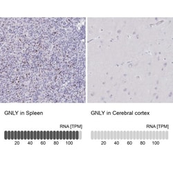 Granulysin Antibody, Novus Biologicals:Antibodies:Primary Antibodies